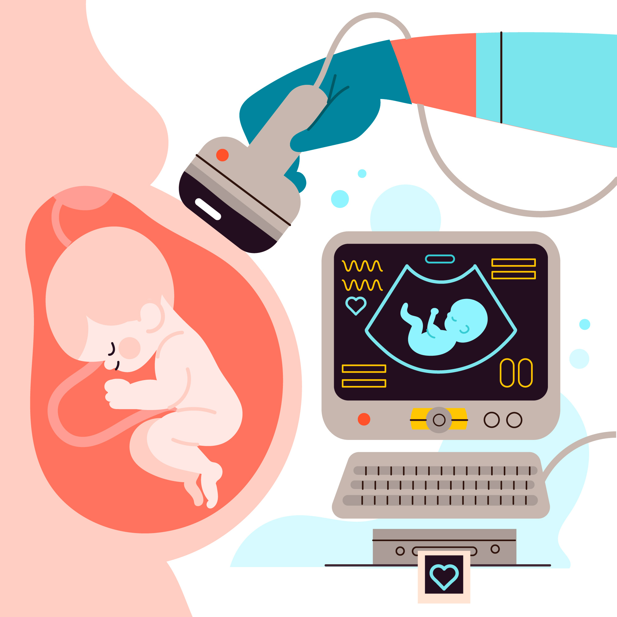 Ultrasound Scan